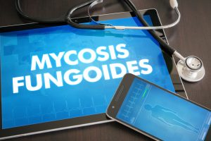 Mycosis fungoides