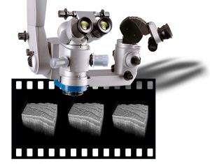 Kopf eines Operationsmikroskops, über den 3-D OCT-Hirngewebeaufnahmen mit Videorate in Echtzeit aufgenommen werden sollen. Quelle: Neuro-OCT.