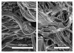 Elastinfasern der Haut
