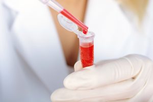 Wissenschaftler mit Blutprobe in Labor für Untersuchung und Auswertung. Foto: © Dan Race - Fotolia.com