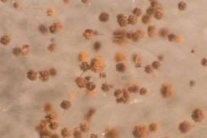 Aspergillus. Foto: © sinhyu - Fotolia.com