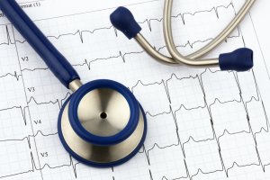 EKG