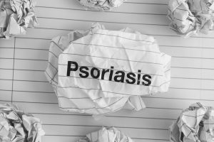 Psoriasis
