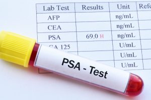 PSA-Test
