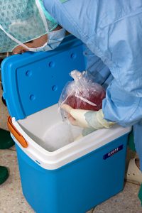 Organ vor der Transplantation