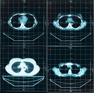 Foto: © pzAxe - Fotolia.com