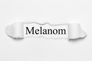Melanom