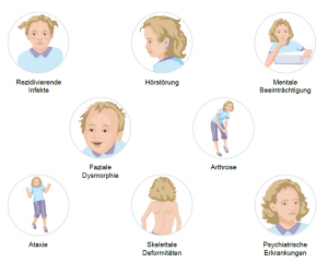 Symptome der Alpha-Mannosidose, © Chiesi GmbH