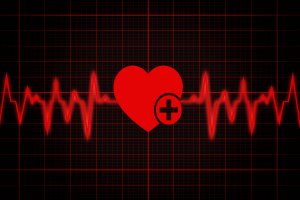 EKG