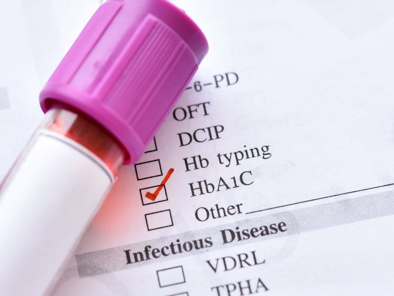 HbA1C