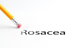 Rosacea
