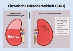 Chronische Nierenkrankheit, Foto: DGfN