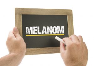 Melanom