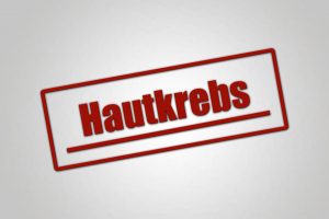 Hautkrebs