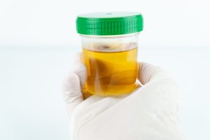 Foto: © Angela Rohde, Fotolia.com