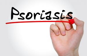 Psoriasis