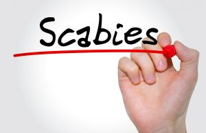Scabies