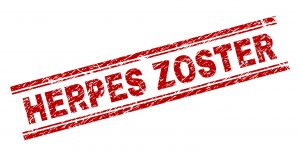 Herpes Zoster