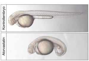 Lichtmikroskopische Aufnahme von zwei Tage alten Zebrafischembryonen. Behandlung mit dem Cholesterinsenker Atorvastatin führt zu stark deformierten Zebrafischembryonen Abbildung: Lars Maerz
