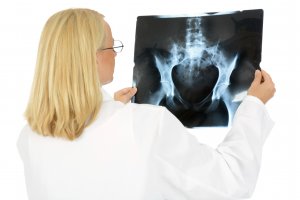 Ärztin betrachtet Röntgenbild