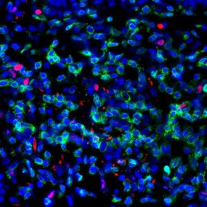 Immunfluoreszenz