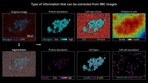 Die bildgebende Massenzytometrie leistet einen wertvollen Beitrag dazu , den Krankheitsverlauf von Typ-1-Diabetes besser zu verstehen. Bild: UZH