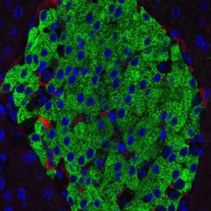 Fluoreszenzmikroskopie einer Langerhans-Insel. Foto: Dr. Doreen Thor
