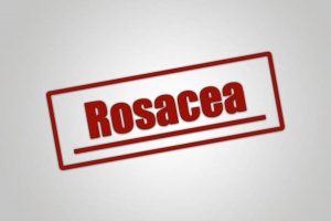Rosacea