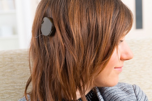 https biermann medizin de praelingual ertaubte cochlea implantat anwender eine sache des trainings