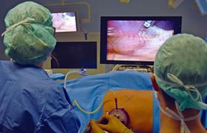 Ein einziger Zugang ist notwendig für den schonenden Eingriff, bei dem die äußerst flexible Kamera zum Einsatz kommt. Foto: Hornberger