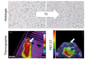 Schilddrüsenhormon (T3) führt zur Umwandlung von weissem Fettgewebe (oben links) in sogenanntes beiges Fettgewebe (oben rechts), welches die Fähigkeit besitzt, Körperfett in Wärme umzuwandeln. Bild: Johann et al.