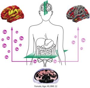Erhöhtes Organfett (Scan unten) beschleunigt die Alterung von Gehirnnetzwerken. Östradiol (Oe) scheint das Gehirn von Frauen während der Lebensmitte vor strukturellen Schäden (rechts oben). Bild: MPI CBS