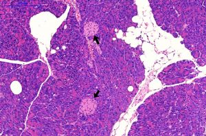 Fettzellen (weiß) und Langerhans-Inseln (schwarze Pfeile) in der Bauchspeicheldrüse einer diabetesanfälligen New Zealand Obese (NZO)-Maus. Lichtmikroskopische Aufnahme, Maßstab 200 Mikromet Bild: DIfE
