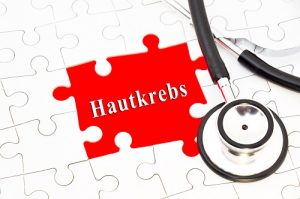 Hautkrebs