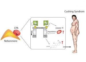 Bei einer Nebenniere mit eine gutartige Nebennierenadenom (links) ist der dem Protein-Kinase-A-Signalweg verändert (Mitte). Die Betroffenen entwickeln in der Folge die typischen Cushing-Syndrom-Merkmale. Illustration: Dr. Isabel Weigand