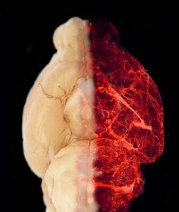 Blutgefäße im transparent erscheinenden Gehirn eines adipösen Mausmodells. Bild: Helmholtz Zentrum München / Tim Gruber