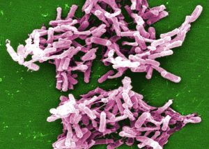 Darmbakterium Clostridioides difficile. Bild: Janice Carr / CDC