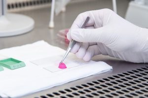 Als Alternative zu Tierversuchen entwickelt ein Forschungsteam am Uniklinikum Jena 3d-Hautinfektionsmodelle, um die Wirksamkeit antimikrobieller Wundheilungsprodukte zu prüfen. Foto: Heiko Hellmann / Universitätsklinikum Jena