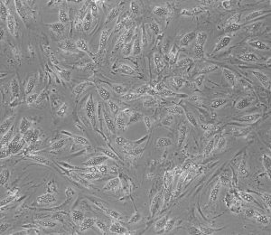 Mikroskopische Aufnahme von humanen Adipozyten, in denen sich Lipidtropfen (weiß) ansammeln. Foto: DIfE