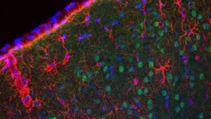 Neuronen (grün) im männlichen Gehirn reagieren auf ein geringeres Insulin Signal. Bild: M. Baghdadi / Max-Planck-Institut für Biologie des Alterns