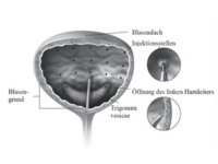 240726_AbbVie_BOTOX_iOAB_Furchert_Grafik_250x150_Biermann