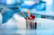 Typ-2-Diabetes: Betroffene mit höherem Risiko für bestimmte Krebsarten könnten durch einen Bluttest identifiziert werden