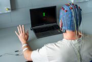 Bessere Erholung nach Schlaganfall: Frühzeitige Kombinationstherapie macht den Unterschied