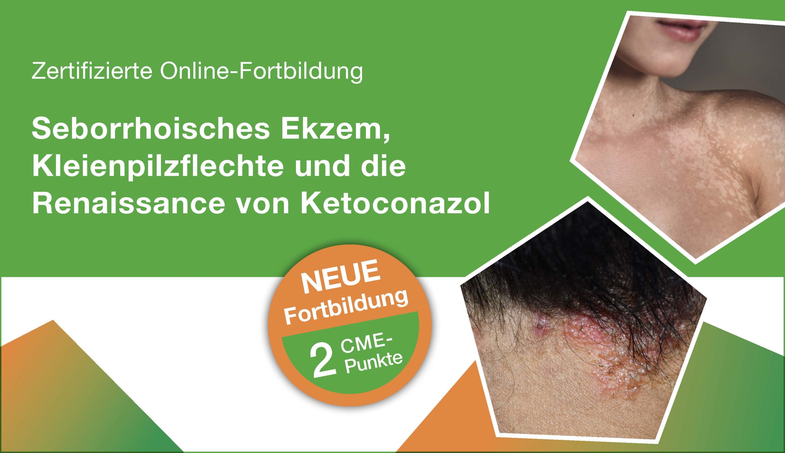 1-Ketozolin_CME Fortbildung