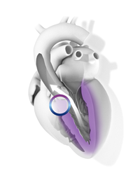 18356_bmscam_valor_heart_200x250px