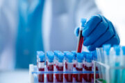 WCLC 2024: Weltweite Umfrage zeigt Fortschritte, aber auch immer noch Hindernisse in Bezug auf Biomarkertests auf