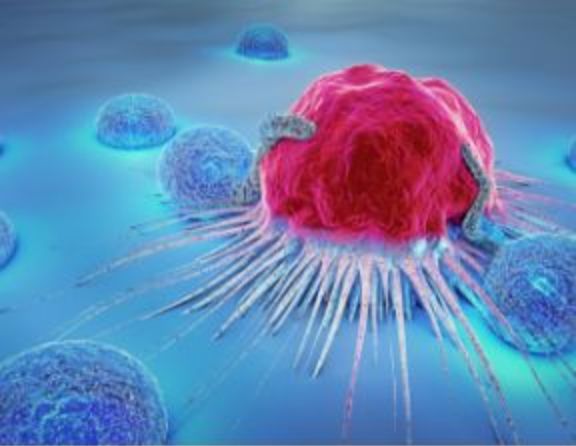 CAR-T-Zellen: Immuntherapie nach Maß
