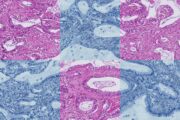 Medizinische Bildgebung: Dateneffizientes KI-Basismodell für die Erkennung von Biomarkern