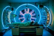 Keine signifikanten Toxizitätsunterschiede bei Prostatakrebsbestrahlung mit Protonen oder Photonen