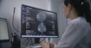 Brustkrebs: Mutationen im Gen BRCA1 können die Fruchtbarkeit beeinträchtigen